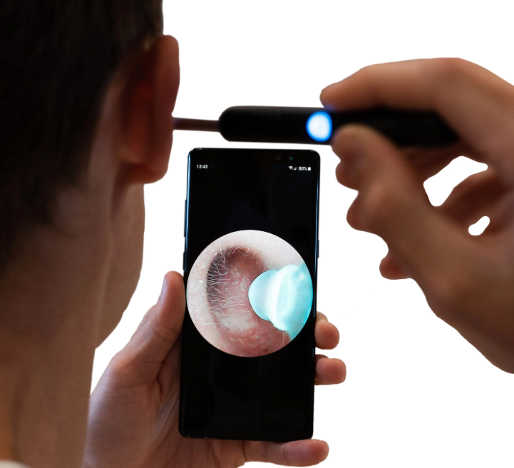 Renova™ EarVision Pro